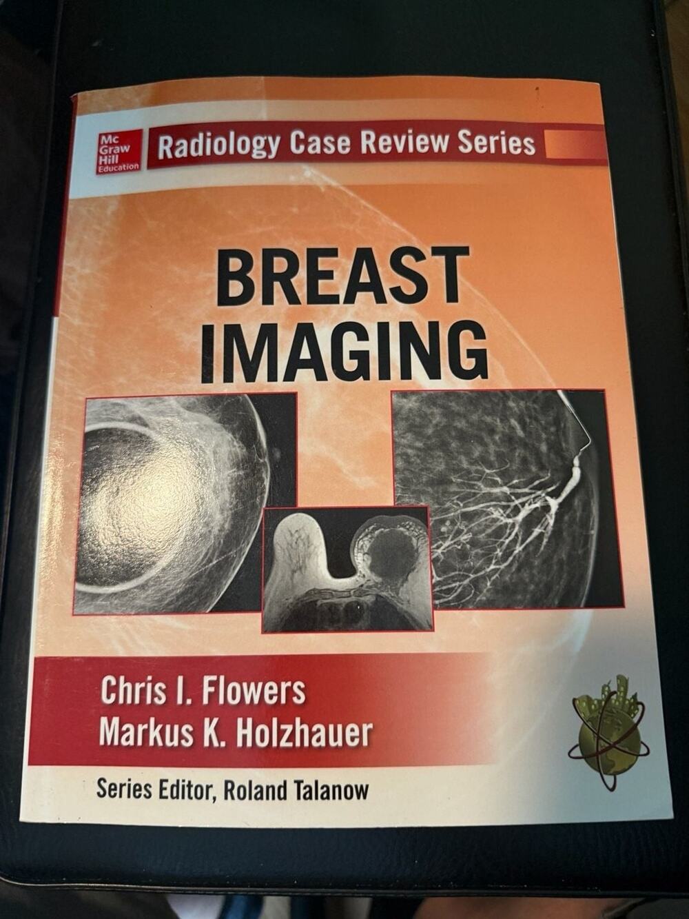 Radiology Case Review Series: Breast Imaging by Chris I. Flowers and Markus K.
